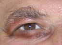 leye2