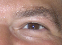 rEye1