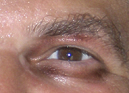 rEye2