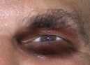 rEye3